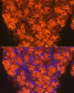 CTRL Recombinant Rabbit Monoclonal Antibody (10Z4K3)