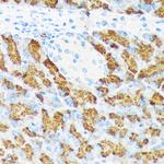 CTRL Antibody in Immunohistochemistry (Paraffin) (IHC (P))