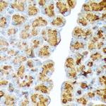 CTRL Antibody in Immunohistochemistry (Paraffin) (IHC (P))