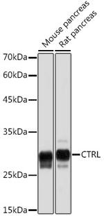 CTRL Antibody in Western Blot (WB)