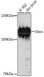 DAXX Recombinant Rabbit Monoclonal Antibody (5B3X4)