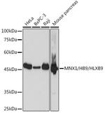 HB9 Recombinant Rabbit Monoclonal Antibody (9P1B7)