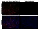 Progesterone Receptor Recombinant Rabbit Monoclonal Antibody (4Y4H5)