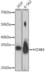 HOXB4 Antibody in Western Blot (WB)