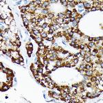 HSPA4 Recombinant Rabbit Monoclonal Antibody (10A9C5)