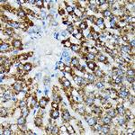 HSPA4 Antibody in Immunohistochemistry (Paraffin) (IHC (P))