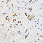 HSPA4 Antibody in Immunohistochemistry (Paraffin) (IHC (P))