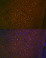 HTR7 Recombinant Rabbit Monoclonal Antibody (4E6D2)