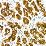 Mammaglobin A Antibody in Immunohistochemistry (Paraffin) (IHC (P))