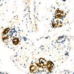 Mammaglobin A Antibody in Immunohistochemistry (Paraffin) (IHC (P))