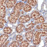 MEKK2 Antibody in Immunohistochemistry (Paraffin) (IHC (P))