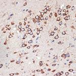 MEKK2 Antibody in Immunohistochemistry (Paraffin) (IHC (P))