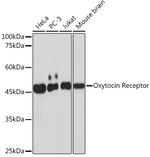 Oxytocin Receptor Recombinant Rabbit Monoclonal Antibody (7X8B8)