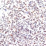 PAX9 Recombinant Rabbit Monoclonal Antibody (3C2U5)