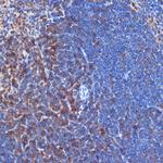 PIK3CD Recombinant Rabbit Monoclonal Antibody (3J0F6)