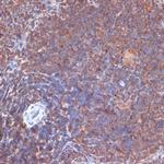 PIK3CD Antibody in Immunohistochemistry (Paraffin) (IHC (P))