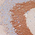 PRKAR2B Recombinant Rabbit Monoclonal Antibody (2U2P1)