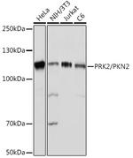 PKN2 Recombinant Rabbit Monoclonal Antibody (5O2G6)