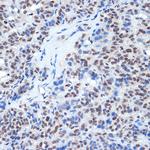 RING1 Recombinant Rabbit Monoclonal Antibody (2Q8D5)