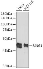 RING1 Antibody in Western Blot (WB)