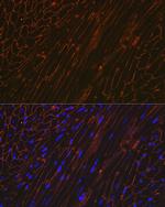Alpha Sarcoglycan Antibody in Immunocytochemistry (ICC/IF)