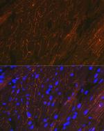 Alpha Sarcoglycan Recombinant Rabbit Monoclonal Antibody (3W3Q10)