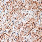 Alpha Sarcoglycan Antibody in Immunohistochemistry (Paraffin) (IHC (P))