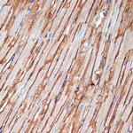 Alpha Sarcoglycan Antibody in Immunohistochemistry (Paraffin) (IHC (P))