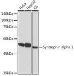 Syntrophin alpha-1 Recombinant Rabbit Monoclonal Antibody (3B10G10)