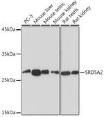 SRD5A2 Recombinant Rabbit Monoclonal Antibody (8A4H5)