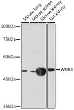 WDR4 Antibody in Western Blot (WB)