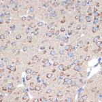 ERP29 Antibody in Immunohistochemistry (Paraffin) (IHC (P))