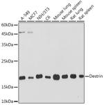 Destrin Recombinant Rabbit Monoclonal Antibody (4F9Q1)