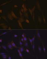 TNPO3 Recombinant Rabbit Monoclonal Antibody (0U3Q1)