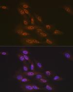 TNPO3 Antibody in Immunocytochemistry (ICC/IF)