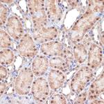 TNPO3 Antibody in Immunohistochemistry (Paraffin) (IHC (P))