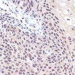 TNPO3 Antibody in Immunohistochemistry (Paraffin) (IHC (P))