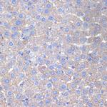 Cytokeratin 18 Antibody in Immunohistochemistry (Paraffin) (IHC (P))