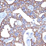 Cytokeratin 18 Recombinant Rabbit Monoclonal Antibody (7B2N3)