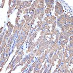 Cytokeratin 18 Antibody in Immunohistochemistry (Paraffin) (IHC (P))