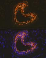 Cytokeratin 18 Antibody in Immunohistochemistry (Paraffin) (IHC (P))