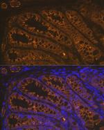Cytokeratin 18 Antibody in Immunohistochemistry (Paraffin) (IHC (P))