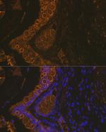 Cytokeratin 18 Antibody in Immunohistochemistry (Paraffin) (IHC (P))