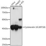 Cytokeratin 18 Antibody in Western Blot (WB)