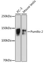 PUM2 Recombinant Rabbit Monoclonal Antibody (7M1B1)