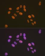 Pokemon Antibody in Immunocytochemistry (ICC/IF)