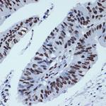 Pokemon Antibody in Immunohistochemistry (Paraffin) (IHC (P))