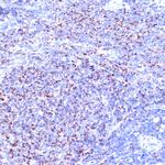TC10 Recombinant Rabbit Monoclonal Antibody (10F7Y7)