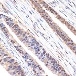 SESN1 Recombinant Rabbit Monoclonal Antibody (7I5Y4)