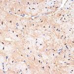 SESN1 Antibody in Immunohistochemistry (Paraffin) (IHC (P))